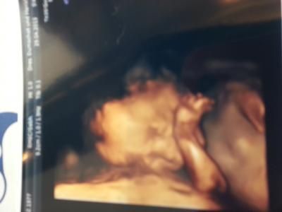 Bild zu Zurück Fd - Forum für September - Mamis
