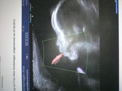 Bild zu noch ein Bild von gestern - Forum für September - Mamis