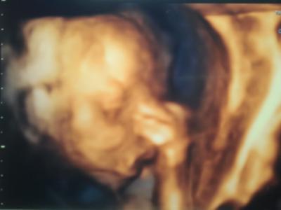 Bild zu Kurze und schöne FD! Es ist... - Forum für September - Mamis