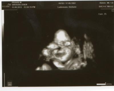 Bild zu Mein erstes 3D-Bild - Forum für September - Mamis