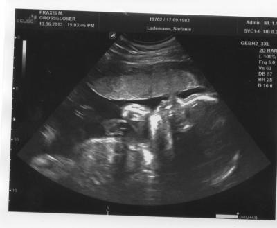 Bild zu Und noch ein anderes Bild! - Forum für September - Mamis