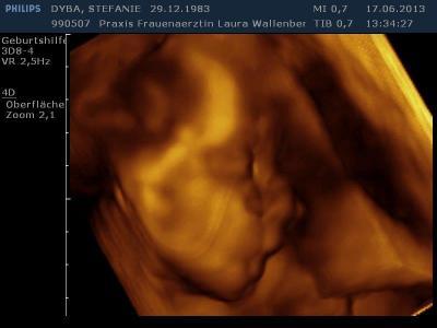 Bild zu Zurück vom Doc - Forum für September - Mamis