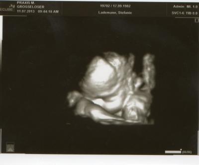 Bild zu Manno, er macht immer die Hände vors Gesicht. ;-) - Forum für September - Mamis