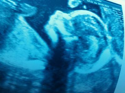 Bild zu Auch NEU hier ! - Forum für September - Mamis