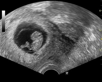 Bild zu verunsichert nach VU - baut mich bitte auf ... - Forum für September - Mamis