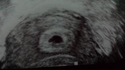 Bild zu 6+1 und kein herzchen - Forum für September - Mamis