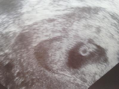 Bild zu Zurück vom FA - Forum für September - Mamis