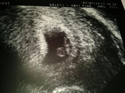 Bild zu endlich... - Forum für September - Mamis