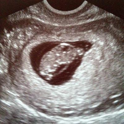 Bild zu Alles gut! - Forum für September - Mamis