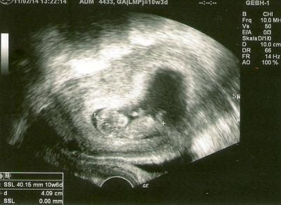 Bild zu Heute 1. großes Screening - Forum für September - Mamis