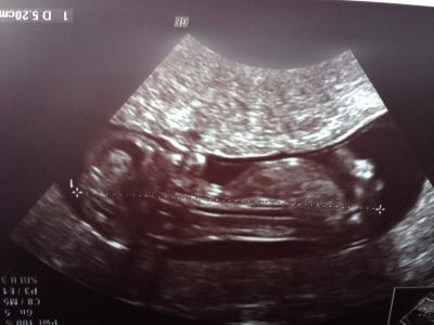 Bild zu So in love... - Forum für September - Mamis