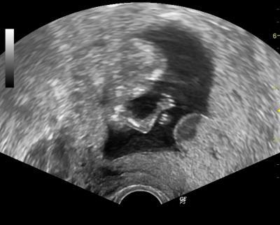Bild zu Ich war auch bei FA :o) - Forum für September - Mamis