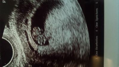 Bild zu soo zurück vom Frauenarzt - Forum für September - Mamis