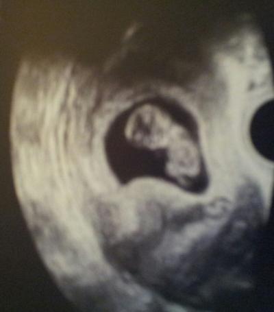 Bild zu Umstieg :-) - Forum für September - Mamis