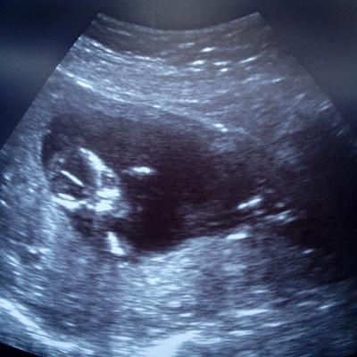 Bild zu Alles gut!!! - Forum für September - Mamis