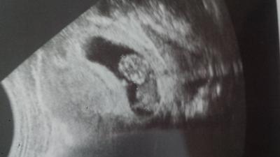 Bild zu alles oke aber trotzdem unsicher - Forum für September - Mamis