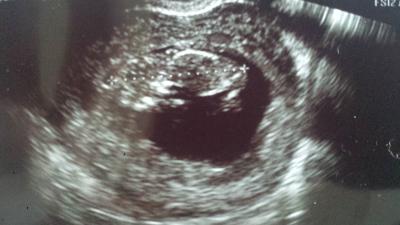 Bild zu zurück vom Fa und 12te woche beendet *-* - Forum für September - Mamis