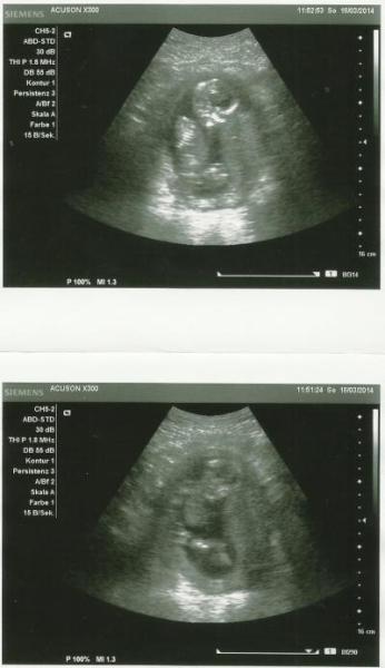 Bild zu VU 15+5 - Forum für September - Mamis