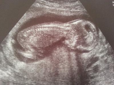 Bild zu Vorsorge gehabt... - Forum für September - Mamis