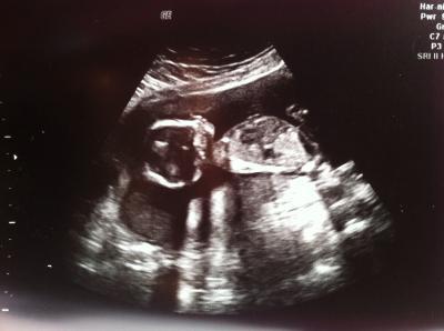 Bild zu Endlich glaube ich es auch... - Forum für September - Mamis