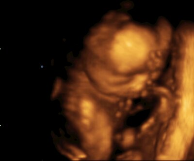Bild zu 2. großer Ultraschall - Forum für September - Mamis