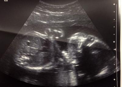 Bild zu Zurück vom 2. Ultraschall - Forum für September - Mamis