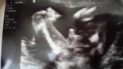 Bild zu ... nach langer zeit mal wieder melden... - Forum für September - Mamis