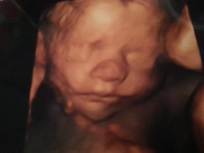 Bild zu 3D Ultraschall und unser Kiwa/Autositz - Forum für September - Mamis