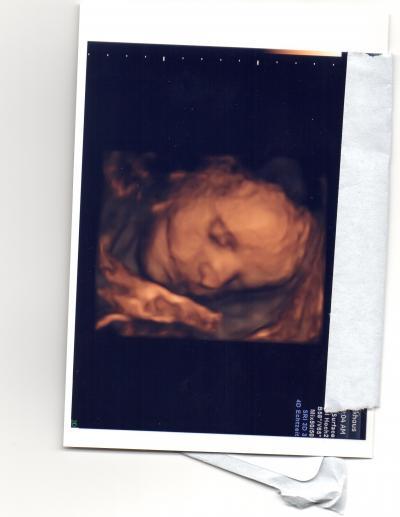 Bild zu Doppler heue morgen - Forum für September - Mamis