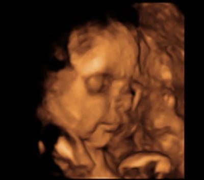 Bild zu War heute beim Doppler Ultraschall - Forum für September - Mamis