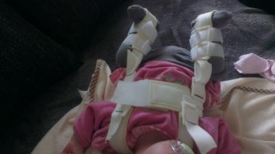 Bild zu Hüfte - Pavlik Bandage :-( - Forum für September - Mamis