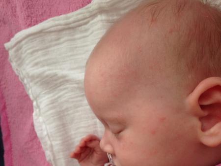 Bild zu 