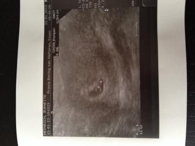 Bild zu FA-Termin gehabt - Forum für September - Mamis