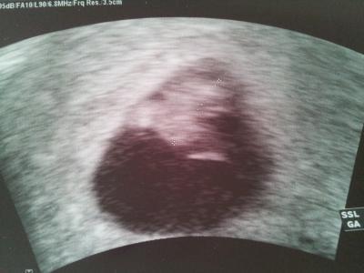 Bild zu Fa Termin - Forum für September - Mamis