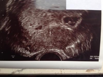 Bild zu Zurück vom FA - Forum für September - Mamis