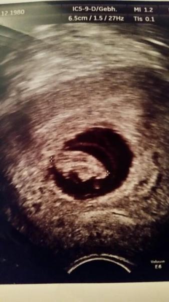 Bild zu Nochmal nen Versuch zwecks Bilder - Forum für September - Mamis