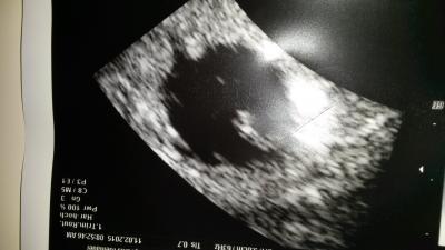 Bild zu Hier auch mal unser Würmchen - Forum für September - Mamis
