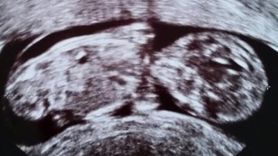 Bild zu Zurück vom FA - Forum für September - Mamis