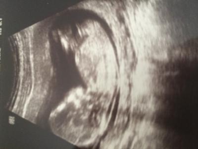 Bild zu FA Termin und vorsichtiges Outing - Forum für September - Mamis