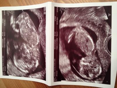 Bild zu Neues von unserem Krümmel - Forum für September - Mamis