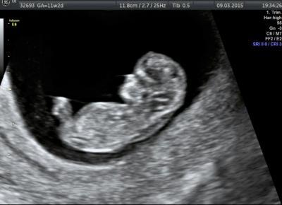 Bild zu Babybild:-) - Forum für September - Mamis
