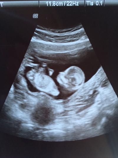 Bild zu 13.Woche - Forum für September - Mamis