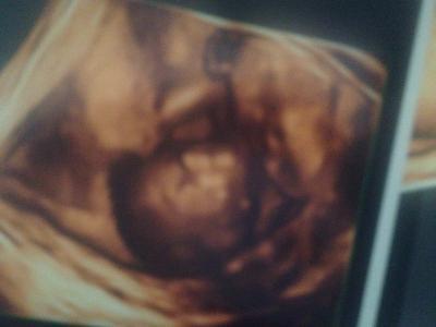 Bild zu 3d mein baby - Forum für September - Mamis