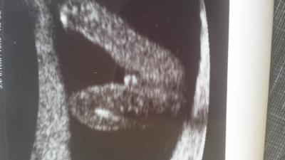 Bild zu Junge oder Mädchen was meint ihr? - Forum für September - Mamis