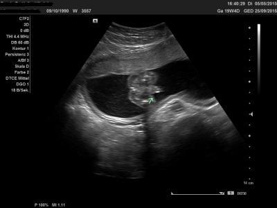 Bild zu Zurück vom Organultraschall... - Forum für September - Mamis