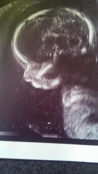 Bild zu FA Termin - Forum für September - Mamis