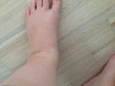 Bild zu Ist das normal?! ... - Forum für September - Mamis