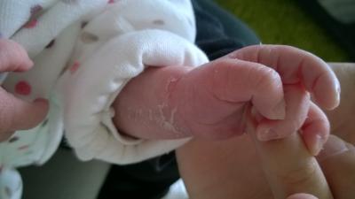 Bild zu schuppen - Forum für September - Mamis