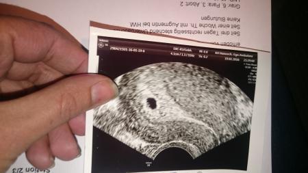 Bild zu Leere Fruchthöhle oder Eckenhocker?? - Forum für September - Mamis