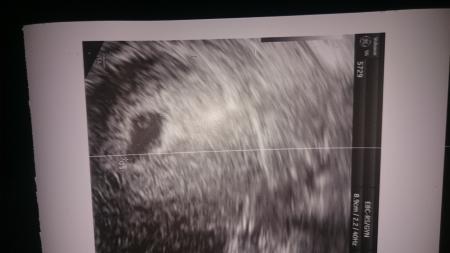 Bild zu Schaut mal was aus meiner leeren Fruchthöhle in 3 Tagen geworden ist... - Forum für September - Mamis